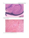 Underlying Mechanisms of Epilepsy