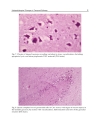 Underlying Mechanisms of Epilepsy