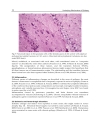 Underlying Mechanisms of Epilepsy