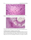 Underlying Mechanisms of Epilepsy