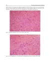 Underlying Mechanisms of Epilepsy