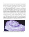 Underlying Mechanisms of Epilepsy