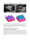 Recent Advances in the Pathogenesis Prevention and Management of Type 2 Diabetes and its Complications