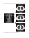 Theory and Applications of CT Imaging and Analysis