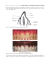 Gingival Diseases Their Aetiology Prevention and Treatment