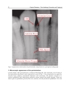 Gingival Diseases Their Aetiology Prevention and Treatment