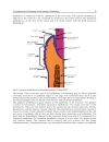 Gingival Diseases Their Aetiology Prevention and Treatment