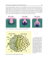 Gingival Diseases Their Aetiology Prevention and Treatment