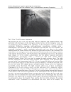 Coronary Angiography The Need for Improvement in Medical and Interventional Therapy