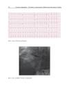 Coronary Angiography The Need for Improvement in Medical and Interventional Therapy