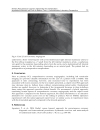 Coronary Angiography The Need for Improvement in Medical and Interventional Therapy