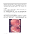 Autoimmune Disorders Current Concepts and Advances from Bedside to Mechanistic Insights