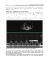 Establishing Better Standards of Care in Doppler Echocardiography Computed Tomography and Nuclear Cardiology