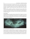 Implant Dentistry A Rapidly Evolving Practice