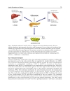 Medical Complications of Type 2 Diabetes