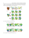 Cardiac Defibrillation Mechanisms Challenges and Implications