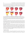 Cardiac Defibrillation Mechanisms Challenges and Implications