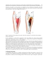 Advanced Techniques in Liposuction and Fat Transfer