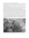 Ectopic Pregnancy Modern Diagnosis and Management