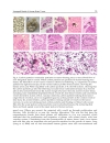 Brain Tumors Current and Emerging Therapeutic Strategies