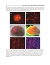 Brain Tumors Current and Emerging Therapeutic Strategies