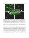 Brain Tumors Current and Emerging Therapeutic Strategies