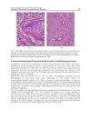 Sarcoidosis Diagnosis and Management