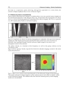 Ultrasound Imaging Medical Applications