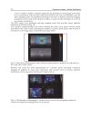 Ultrasound Imaging Medical Applications