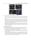 Ultrasound Imaging Medical Applications