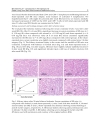 Kidney Transplantation New Perspectives