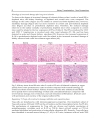 Kidney Transplantation New Perspectives