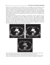 CT Scanning Techniques and Applications