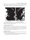 CT Scanning Techniques and Applications