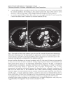 CT Scanning Techniques and Applications