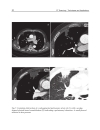 CT Scanning Techniques and Applications