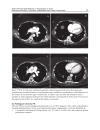 CT Scanning Techniques and Applications