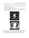 CT Scanning Techniques and Applications