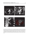 CT Scanning Techniques and Applications