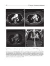 CT Scanning Techniques and Applications