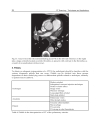 CT Scanning Techniques and Applications