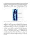 Glaucoma Basic and Clinical Concepts