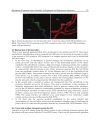 Glaucoma Basic and Clinical Concepts