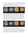 Alzheimerâ s Disease Pathogenesis Core Concepts Shifting Paradigms and Therapeutic Targets