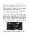 Diagnosis and Treatment of Parkinsonâ s Disease