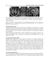 Diagnosis and Treatment of Parkinsonâ s Disease