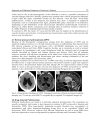 Diagnosis and Treatment of Parkinsonâ s Disease