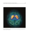 Diagnosis and Treatment of Parkinsonâ s Disease