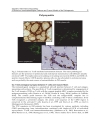 Idiopathic Inflammatory Myopathies â Recent Developments