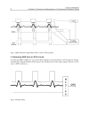 Cardiac Defibrillation Prediction Prevention and Management of Cardiovascular Arrhythmic Events